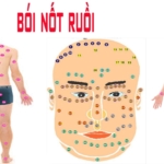 Xem tướng nốt ruồi trên cơ thể biết tính cách và số phận