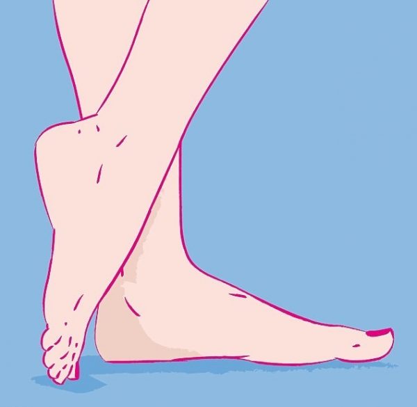 Bàn chân bằng phẳng