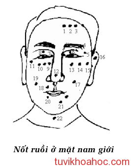 nốt ruồi trên mặt