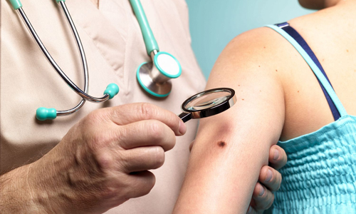 Ý nghĩa nốt ruồi son trên ngực phụ nữ