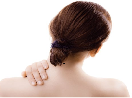 Nốt ruồi đằng sau gáy có ý nghĩa gì?